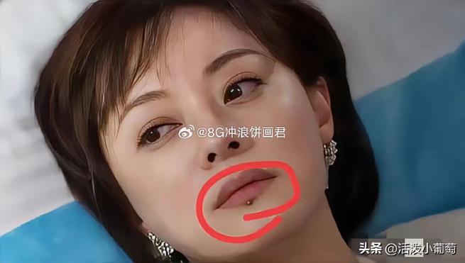 2025年澳门天天彩大全和孙俪唇下痣没了与孙俪嘴唇的痣